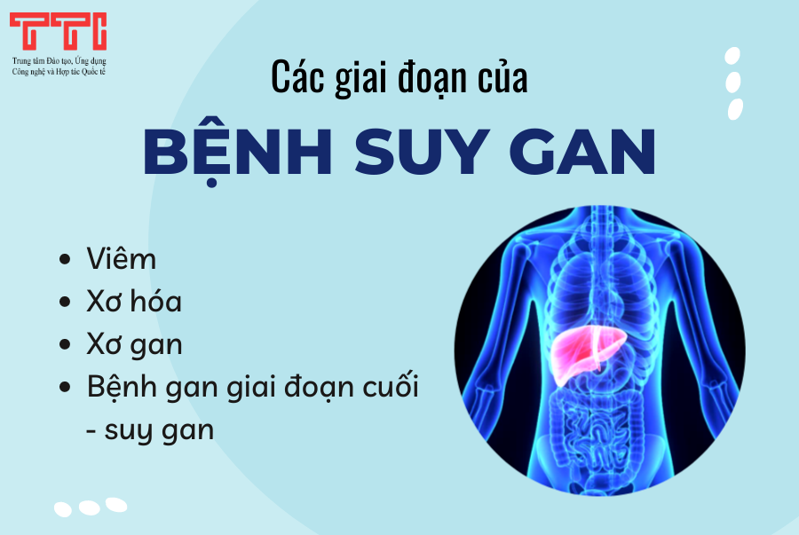 Các giai đoạn của suy gan